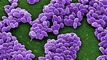 Image of close up anthrax bacteria