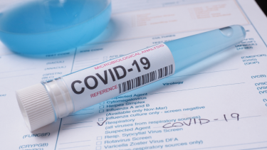 COVID-19 lab test